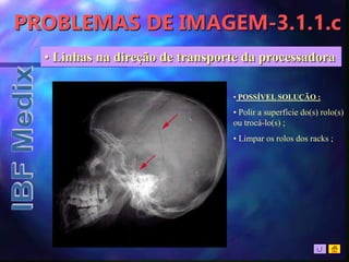 PROBLEMAS DE IMAGEM-3.1.1.c
• Linhas na direção de transporte da processadora
• POSSÍVEL SOLUÇÃO :
• Polir a superfície do(s) rolo(s)
ou trocá-lo(s) ;
• Limpar os rolos dos racks ;
 