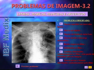 PROBLEMAS DE IMAGEM-3.2
LINHAS , MARCAS, MANCHAS E ARTEFATOS
• PROBLEMA OBSERVADO:
• Marcas repetidas em intervalos
iguais;
• Marcas de digitais ;
• Marcas em forma de meia-Lua;
• Marcas devido à descarga
eletrostática ;
• Bordas negras no filme ;
• Ondulações no filme ;
• Artefatos distribuídos
randomicamente no filme , com queda de
densidade ótica da imagem
• Marcas pretas e brancas
distribuídas randomicamente pelo filme
Próximo problema
 