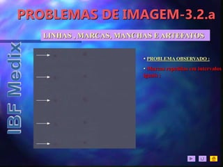 PROBLEMAS DE IMAGEM-3.2.a
LINHAS , MARCAS, MANCHAS E ARTEFATOS
• PROBLEMA OBSERVADO :
• Marcas repetidas em intervalos
iguais ;
 