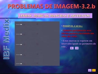 PROBLEMAS DE IMAGEM-3.2.b
LINHAS , MARCAS, MANCHAS E ARTEFATOS
• POSSÍVEL CAUSA :
• Químico parcialmente seco
(forma pastosa) encrostado nos
rolos dos racks .
• Estas marcas se repetem em
intervalos iguais ao perímetro do
rolo .
 