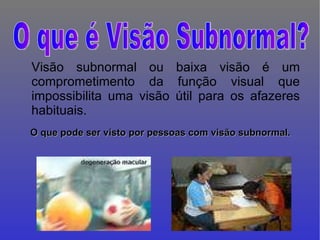 Visão subnormal ou baixa visão é um comprometimento da função visual que impossibilita uma visão útil para os afazeres habituais. O que pode ser visto por pessoas com visão subnormal. O que é Visão Subnormal? 