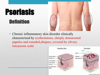 Definition
• Chronic inflammatory skin disorder clinically
characterized by erythematous, sharply demarcated
papules and rounded plaques, covered by silvery
micaceous scale
Psoriasis
 