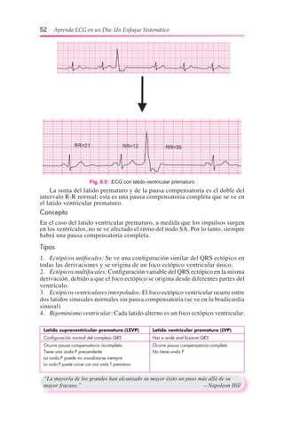 58 Aprenda ECG en un Día: Un Enfoque Sistemático
2. Patológicas:
• Hipotiroidismo
• Aumento de la presión intracraneal
• I...
