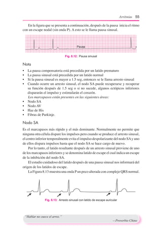 Arritmias 61
Puntos Taquicardia sinusal Taquicardia supraventricular
Inicio Gradual Súbito
Frecuencia cardiaca 160 por min...