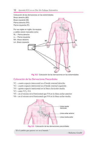 12  Aprenda ECG en un Día: Un Enfoque Sistemático
Fig. 5.2:  Colocación de las derivaciones en las extremidades
Colocación de las derivaciones en las extremidades:
Brazo derecho (BD)
Brazo izquierdo (BI)
Pierna derecha (PD)
Pierna izquierda (PI)
Por sus siglas en inglés, los equipos
y cables vienen marcados como:
RL - Pierna derecha
LL - Pierna izquierda
RA - Brazo derecho
LA - Brazo izquierdo
Colocación de las Derivaciones Precordiales
V1 – cuarto espacio intercostal en el borde esternal derecho
V2 – cuarto espacio intercostal en el borde esternal izquierdo
V4 – quinto espacio intercostal en la línea clavicular media
V3 – entre V2 y V4
V5 – en el mismo nivel horizontal que V4 en la línea axilar anterior
V6 – en el mismo nivel horizontal que V4 en la línea axilar media.
Fig. 5.3:  Colocación de las derivaciones precordiales
“Sé el cambio que quieres ver en el mundo.”
	 —Mahatma Gandhi
 