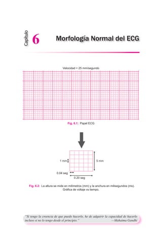Fig. 6.1:  Papel ECG
Fig. 6.2:  La altura se mide en milímetros (mm) y la anchura en milisegundos (ms). 	
Gráfica de voltaje vs tiempo.
“Si tengo la creencia de que puedo hacerlo, he de adquirir la capacidad de hacerlo
incluso si no lo tengo desde el principio.”	 —Mahatma Gandhi
Morfología Normal del ECG
Capítulo
6
Velocidad = 25 mm/segundo
0.04 seg
0.20 seg
 