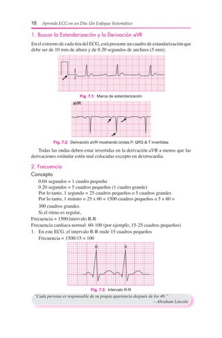 18  Aprenda ECG en un Día: Un Enfoque Sistemático
1. Buscar la Estandarización y la Derivación aVR
En el extremo de cada tira del ECG, está presente un cuadro de estandarización que
debe ser de 10 mm de altura y de 0.20 segundos de anchura (5 mm).
Fig. 7.2:  Derivación aVR mostrando ondas P, QRS & T invertidas
Fig. 7.1:  Marca de estandarización
	 Todas las ondas deben estar invertidas en la derivación aVR a menos que las
derivaciones estándar estén mal colocadas excepto en dextrocardia.
2. Frecuencia
Concepto
	 0.04 segundos = 1 cuadro pequeño
	 0.20 segundos = 5 cuadros pequeños (1 cuadro grande)
	 Por lo tanto, 1 segundo = 25 cuadros pequeños o 5 cuadros grandes
	 Por lo tanto, 1 minuto = 25 x 60 = 1500 cuadros pequeños o 5 x 60 =
	 300 cuadros grandes.
	 Si el ritmo es regular,
Frecuencia = 1500/intervalo R-R
Frecuencia cardiaca normal: 60-100 (por ejemplo, 15-25 cuadros pequeños)
1.	 En este ECG, el intervalo R-R mide 15 cuadros pequeños
	 Frecuencia = 1500/15 = 100
Fig. 7.3:  Intervalo R-R
“Cada persona es responsable de su propia apariencia después de los 40.”
	 —Abraham Lincoln
 