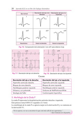 20  Aprenda ECG en un Día: Un Enfoque Sistemático
Causas
	 Desviación del eje a la derecha	 Desviación del eje a la izquierda
	 Hipertrofia ventricular derecha	 Hipertrofia ventricular izquierda
	 Bloqueo de rama derecha	 Bloqueo de rama izquierda
	 Hemibloqueo posterior izquierdo	 Hemibloqueo anterior izquierdo		
	 Enfisema y cor pulmonale	 Síndrome de Wolf-Parkinson-White
	 Tetralogía de Fallot	 Cardiomiopatía hipertrófica
5. Morfología de la Onda P
La onda P representa la despolarización aurícular derecha e izquierda.
Este proceso toma 0.08-0.11 segundos (2-3 mm)
La morfología de la onda P se aprecia mejor en la derivación II y se contrasta en
la derivación V1.
Fig. 7.6:  Comparación de la derivación I con aVF para obtener el eje
Fig. 7.8:  Desviación del eje a la izquierdaFig. 7.7:  Desviación del eje a la derecha
“Si no esperas, no vas a encontrar lo que está más allá de tus esperanzas.”
	 —San Clemente de Alejandría
 