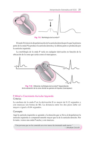 Interpretación Sistemática del ECG 21
	 El nodo SAinicia la despolarización de la aurícula derecha por lo que la primera
parte de la onda P la produce la aurícula derecha y la última parte es producida por
la aurícula izquierda.
	 La morfología de la onda P varía en cualquier derivación en función de la
ubicación de la zona que actúa como el marcapasos.
Fig. 7.10:  Diferente morfología de la onda P dependiendo
de la ubicación de la zona donde se genera el impulso (marcapaso)
P Mitral o Crecimiento Auricular Izquierdo
Criterios
La anchura de la onda P en la derivación II es mayor de 0.12 segundos y
con muescas (en forma de M). La distancia entre los dos picos debe ser
mayor o igual a 0.04 segundos.
Concepto
Aquí la aurícula izquierda se agranda y la duración que se lleva al despolarizar la
aurícula izquierda es comparativamente mayor que la de la aurícula derecha. Por
lo tanto, vemos una onda P ancha y con muescas.
“Una persona que no ha cometido un error nunca ha intentado nada nuevo.”
	 —Abraham Lincoln
Fig. 7.9:  Morfología de la onda P
Onda P
 