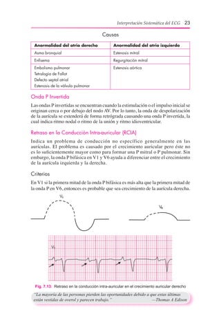 Interpretación Sistemática del ECG 23
Causas
	 Anormalidad del atrio derecho	 Anormalidad del atrio izquierdo
	 Asma bronquial	 Estenosis mitral
	 Enfisema	 Regurgitación mitral
	 Embolismo pulmonar	 Estenosis aórtica
	 Tetralogía de Fallot
	 Defecto septal atrial
	 Estenosis de la válvula pulmonar
Onda P Invertida
Las ondas P invertidas se encuentran cuando la estimulación o el impulso inicial se
originan cerca o por debajo del nodo AV. Por lo tanto, la onda de despolarización
de la aurícula se extenderá de forma retrógrada causando una onda P invertida, la
cual indica ritmo nodal o ritmo de la unión y ritmo idioventricular.
Retraso en la Conducción Intra-auricular (RCIA)
Indica un problema de conducción no específico generalmente en las
aurículas. El problema es causado por el crecimiento auricular pero éste no
es lo suficientemente mayor como para formar una P mitral o P pulmonar. Sin
embargo, la onda P bifásica en V1 y V6 ayuda a diferenciar entre el crecimiento
de la aurícula izquierda y la derecha.
Criterios
En V1 si la primera mitad de la onda P bifásica es más alta que la primera mitad de
la onda P en V6, entonces es probable que sea crecimiento de la aurícula derecha.
Fig. 7.13:  Retraso en la conducción intra-auricular en el crecimiento auricular derecho
“La mayoría de las personas pierden las oportunidades debido a que estas últimas
están vestidas de overol y parecen trabajo.”	 —Thomas A Edison
 