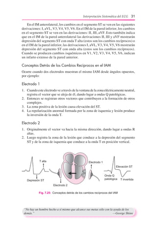 Interpretación Sistemática del ECG 31
	 En el IM anterolateral, los cambios en el segmento ST se ven en las siguientes
derivaciones: I, aVL, V3, V4, V5, V6. En el IM de la pared inferior, los cambios
en el segmento ST se ven en las derivaciones: II, III, aVF. Esto también indica
que en el IM de la pared anterolateral las derivaciones II, III y aVF mostrarán
depresión del segmento ST con onda T alta (estos son los cambios recíprocos) o
en el IM de la pared inferior, las derivaciones I, aVL, V3, V4, V5, V6 mostrarán
depresión del segmento ST con onda alta (estos son los cambios recíprocos).
Cuando se producen cambios isquémicos en V1, V2, V3, V4, V5, V6, indican
un infarto extenso de la pared anterior.
Conceptos Detrás de los Cambios Recíprocos en el IAM
Ocurre cuando dos electrodos muestran el mismo IAM desde ángulos opuestos,
por ejemplo:
Electrodo 1
1.	 Cuando este electrodo ve a través de la ventana de la zona eléctricamente neutral,
registra el vector que se aleja de él, dando lugar a ondas Q patológicas.
2.	 Entonces se registran otros vectores que contribuyen a la formación de otros
complejos.
3.	 La zona positiva de la lesión causa elevación del ST.
4.	 La repolarización anormal formada por la zona de isquemia y lesión produce
la inversión de la onda T.
Electrodo 2
1.	 Originalmente el vector va hacia la misma dirección, dando lugar a ondas R
altas.
2.	 Luego registra la zona de la lesión que conduce a la depresión del segmento
ST y de la zona de isquemia que conduce a la onda T en posición vertical.
Fig. 7.25:  Conceptos detrás de los cambios recíprocos del IAM
“No hay un hombre hecho a sí mismo que alcance sus metas sólo con la ayuda de los
demás.”	 —George Shinn
   T alta
Depresión ST
Electrodo 1
Electrodo 2
Elevación ST
Onda Q
patológica T invertida
 