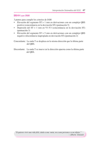 Interpretación Sistemática del ECG 47
BRIHH con IAM
3 puntos para cumplir los criterios de IAM
•	 Elevación del segmento ST > 1 mm en derivaciones con un complejo QRS
positivo (concordancia en la desviación ST) (puntuación 5)
•	 Depresión del ST > 1 mm en V1-V3 (concordancia en la desviación ST)
(puntuación 3)
•	 Elevación del segmento ST > 5 mm en derivaciones con un complejo QRS
negativo (discordancia inapropiada en desviación ST) (puntuación 2)
Concordante:  La onda T se desplaza en la misma dirección que la última parte 	 	
	          del QRS.
Discordante:   La onda T se mueve en la dirección opuesta como la última parte
                       del QRS.
“Si quieres vivir una vida feliz, átala a una meta, no a una persona o a un objeto.”
	 —Alberto Einstein
 