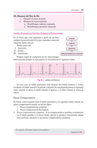 Latidos Prematuros/Latidos Ectópicos/Extrasístoles
Es el ritmo que está surgiendo a partir de un foco
ectópico fuera del nodo SAy que se produce antes del
siguiente latido sinusal.
	 Puede surgir del:
	 I.	 Aurículas
	II.	 Nodos
III.	 Ventrículos
	 Pueden surgir de cualquiera de los mencionados
anteriormente porque el marcapasos se encuentra en el siguiente orden:
Fig. 8.1:  Latidos prematuros
	 En este caso el latido prematuro está después del latido número 3. Como
resultado, el latido sinusal 4 se pierde y después de una pequeña pausa el siguiente
ritmo sinusal, es decir, el latido número 5 aparece y el ritmo sinusal se inicia de
nuevo.
Pausa Compensatoria
Se define como la pausa entre el latido prematuro y el siguiente latido sinusal. La
pausa compensatoria puede ser de dos tipos:
	 1.	 Pausa compensatoria completa
	 2.	 Pausa compensatoria incompleta.
1.	 Pausa compensatoria completa: Si la compensación se produce exactamente
en el latido perdido y el tercer latido sinusal se produce exactamente donde
otro ocurriría, entonces es una pausa compensatoria completa.
“No esperes. El tiempo nunca será perfecto.”
	 —Napoleon Hill
III.	Bloqueos del Haz de His
	 i.	 Bloqueo de rama derecha
	 ii.	 Bloqueo de rama izquierda
	 a.	 Hemibloqueo anterior izquierdo
	 a.	 Hemibloqueo posterior izquierdo
Arritmias 49
 