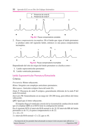 50  Aprenda ECG en un Día: Un Enfoque Sistemático
2.	 Pausa compensatoria incompleta: ISi el latido que sigue al latido prematuro
se produce antes del siguiente latido, entonces es una pausa compensatoria
incompleta.
Dependiendo del sitio de origen del latido prematuro se clasifica como –
	 I.	 Latido supraventricular prematuro
	II.	 Latido ventricular prematuro.
Latido Supraventricular Prematuro/Extrasístole
Criterios
Frecuencia: Ritmo subyacente.
Ritmo: Irregular con complejos auriculares prematuros.
Marcapaso: Auricular ectópico fuera del nodo SA.
Onda P: Presencia de onda P ectópica, generalmente diferente de la onda P del
nodo SA normal.
Intervalo PR: Generalmente en un rango de 120-200 mseg, pero difiere del ritmo
subyacente.
QRS: Igual que el ritmo subyacente.
	 El impulso llega al ventrículo a través de la vía normal de conducción de modo
que el complejo QRS en el ECG tiene la configuración normal.
En el siguiente ECG el intervalo R-R normal es de 18. El intervalo RR del latido
prematuro es de 11 y la pausa compensatoria es de 22.
11 + 22 = 33
2 x intervalo R-R normal = 2 x 22, que es 44.
“La mayoría de los grandes han alcanzado su mayor éxito un paso más allá de su
mayor fracaso.”	 —Napoleon Hill
Fig. 8.2:  Pausa compensatoria completa
Fig. 8.3:  Pausa compensatoria incompleta
	 V	 Presencia de onda R.
	 	 Presencia de onda P.
 