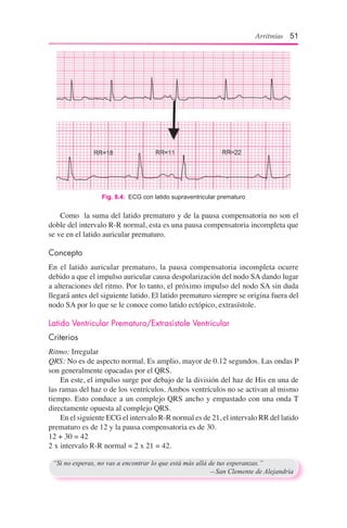 Arritmias 51
Fig. 8.4:  ECG con latido supraventricular prematuro
	 Como la suma del latido prematuro y de la pausa compensatoria no son el
doble del intervalo R-R normal, esta es una pausa compensatoria incompleta que
se ve en el latido auricular prematuro.
Concepto
En el latido auricular prematuro, la pausa compensatoria incompleta ocurre
debido a que el impulso auricular causa despolarización del nodo SA dando lugar
a alteraciones del ritmo. Por lo tanto, el próximo impulso del nodo SA sin duda
llegará antes del siguiente latido. El latido prematuro siempre se origina fuera del
nodo SA por lo que se le conoce como latido ectópico, extrasístole.
Latido Ventricular Prematuro/Extrasístole Ventricular
Criterios
Ritmo: Irregular
QRS: No es de aspecto normal. Es amplio, mayor de 0.12 segundos. Las ondas P
son generalmente opacadas por el QRS.
	 En este, el impulso surge por debajo de la división del haz de His en una de
las ramas del haz o de los ventrículos. Ambos ventrículos no se activan al mismo
tiempo. Esto conduce a un complejo QRS ancho y empastado con una onda T
directamente opuesta al complejo QRS.
	 En el siguiente ECG el intervalo R-R normal es de 21, el intervalo RR del latido
prematuro es de 12 y la pausa compensatoria es de 30.
12 + 30 = 42
2 x intervalo R-R normal = 2 x 21 = 42.
“Si no esperas, no vas a encontrar lo que está más allá de tus esperanzas.”
	 —San Clemente de Alejandría
 