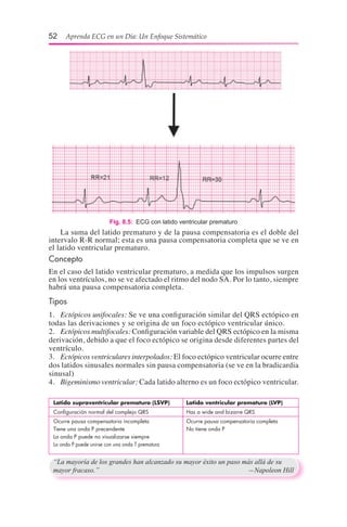 52  Aprenda ECG en un Día: Un Enfoque Sistemático
“La mayoría de los grandes han alcanzado su mayor éxito un paso más allá de su
mayor fracaso.”	 —Napoleon Hill
Fig. 8.5:  ECG con latido ventricular prematuro
	 La suma del latido prematuro y de la pausa compensatoria es el doble del
intervalo R-R normal; esta es una pausa compensatoria completa que se ve en
el latido ventricular prematuro.
Concepto
En el caso del latido ventricular prematuro, a medida que los impulsos surgen
en los ventrículos, no se ve afectado el ritmo del nodo SA. Por lo tanto, siempre
habrá una pausa compensatoria completa.
Tipos
1.	 Ectópicos unifocales: Se ve una configuración similar del QRS ectópico en
todas las derivaciones y se origina de un foco ectópico ventricular único.
2.	 Ectópicos multifocales: Configuración variable del QRS ectópico en la misma
derivación, debido a que el foco ectópico se origina desde diferentes partes del
ventrículo.
3.	 Ectópicos ventriculares interpolados: El foco ectópico ventricular ocurre entre
dos latidos sinusales normales sin pausa compensatoria (se ve en la bradicardia
sinusal)
4.	 Bigeminismo ventricular: Cada latido alterno es un foco ectópico ventricular.
Latido supraventricular prematuro (LSVP)	 Latido ventricular prematuro (LVP)
Configuración normal del complejo QRS	 Has a wide and bizarre QRS
Ocurre pausa compensatoria incompleta	 Ocurre pausa compensatoria completa
Tiene una onda P precendente	 No tiene onda P
La onda P puede no visualizarse siempre
La onda P puede unirse con una onda T prematura
 