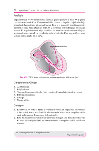 68  Aprenda ECG en un Día: Un Enfoque Sistemático
Fig. 8.33:  WPW tienen un tracto que no pasa por el nodo AV (haz de Kent)
“La victoria pertenece al más perseverante.”
	 —Napoleón Bonaparte
Patología
El paciente con WPW tienen un haz anómalo que no pasa por el nodo AV y que se
conoce como haz de Kent. En esta condición, cuando el impulso viaja hacia abajo
a través de las aurículas alcanza el haz de Kent y el nodo AV simultáneamente.
El impulso viaja hacia abajo del nodo AV y encuentra con un bloqueo fisiológico
normal. El impulso también viaja por el haz de Kent sin encontrarse con bloqueo
y así comienza a extenderse por el miocardio ventricular. Esta progresión es lenta
y da un patrón ancho en el ECG.
Características Clínicas
1.	 Asintomática
2.	 Palpitaciones
3.	 Taquicardia supraventricular (más común), debido al circuito de reentrada
4.	 Fibrilación auricular
5.	 Síncope
6.	 Muerte súbita.
Concepto
1.	 El intervalo PR corto se debe a la conducción rápida del impulso de las aurículas
a los ventrículos a través de la vía accesoria provocando despolarización
ventricular precoz de una parte del ventrículo.
2.	 Esta despolarización ventricular temprana da lugar a la llamada onda delta.
El resto del complejo QRS se forma debido a la despolarización ventricular
restante.
 