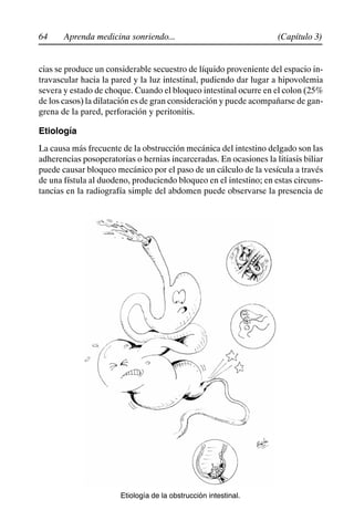 64 (Capítulo 3)
Aprenda medicina sonriendo...
cias se produce un considerable secuestro de líquido proveniente del espacio in-
travascular hacia la pared y la luz intestinal, pudiendo dar lugar a hipovolemia
severa y estado de choque. Cuando el bloqueo intestinal ocurre en el colon (25%
de los casos) la dilatación es de gran consideración y puede acompañarse de gan-
grena de la pared, perforación y peritonitis.
Etiología
La causa más frecuente de la obstrucción mecánica del intestino delgado son las
adherencias posoperatorias o hernias incarceradas. En ocasiones la litiasis biliar
puede causar bloqueo mecánico por el paso de un cálculo de la vesícula a través
de una fístula al duodeno, produciendo bloqueo en el intestino; en estas circuns-
tancias en la radiografía simple del abdomen puede observarse la presencia de
Etiología de la obstrucción intestinal.
 