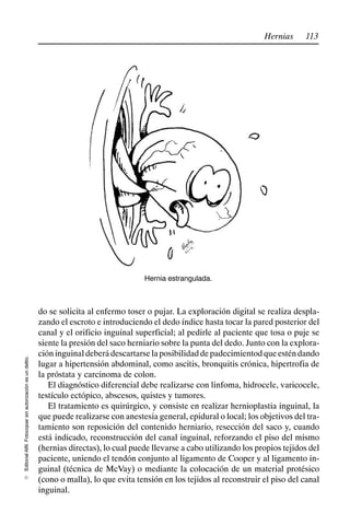 113
Hernias
Editorial
Alfil.
Fotocopiar
sin
autorización
es
un
delito.
E
Hernia estrangulada.
do se solicita al enfermo toser o pujar. La exploración digital se realiza despla-
zando el escroto e introduciendo el dedo índice hasta tocar la pared posterior del
canal y el orificio inguinal superficial; al pedirle al paciente que tosa o puje se
siente la presión del saco herniario sobre la punta del dedo. Junto con la explora-
cióninguinaldeberádescartarselaposibilidaddepadecimientodqueesténdando
lugar a hipertensión abdominal, como ascitis, bronquitis crónica, hipertrofia de
la próstata y carcinoma de colon.
El diagnóstico diferencial debe realizarse con linfoma, hidrocele, varicocele,
testículo ectópico, abscesos, quistes y tumores.
El tratamiento es quirúrgico, y consiste en realizar hernioplastia inguinal, la
que puede realizarse con anestesia general, epidural o local; los objetivos del tra-
tamiento son reposición del contenido herniario, resección del saco y, cuando
está indicado, reconstrucción del canal inguinal, reforzando el piso del mismo
(hernias directas), lo cual puede llevarse a cabo utilizando los propios tejidos del
paciente, uniendo el tendón conjunto al ligamento de Cooper y al ligamento in-
guinal (técnica de McVay) o mediante la colocación de un material protésico
(cono o malla), lo que evita tensión en los tejidos al reconstruir el piso del canal
inguinal.
 