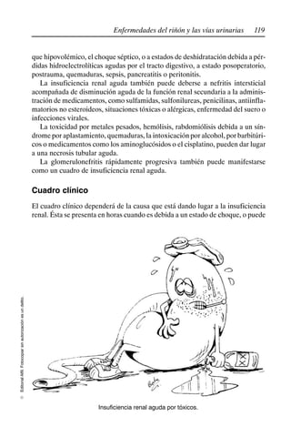 119
Enfermedades del riñón y las vías urinarias
Editorial
Alfil.
Fotocopiar
sin
autorización
es
un
delito.
E
que hipovolémico, el choque séptico, o a estados de deshidratación debida a pér-
didas hidroelectrolíticas agudas por el tracto digestivo, a estado posoperatorio,
postrauma, quemaduras, sepsis, pancreatitis o peritonitis.
La insuficiencia renal aguda también puede deberse a nefritis intersticial
acompañada de disminución aguda de la función renal secundaria a la adminis-
tración de medicamentos, como sulfamidas, sulfonilureas, penicilinas, antiinfla-
matorios no esteroideos, situaciones tóxicas o alérgicas, enfermedad del suero o
infecciones virales.
La toxicidad por metales pesados, hemólisis, rabdomiólisis debida a un sín-
drome por aplastamiento, quemaduras, la intoxicación por alcohol, por barbitúri-
cos o medicamentos como los aminoglucósidos o el cisplatino, pueden dar lugar
a una necrosis tubular aguda.
La glomerulonefritis rápidamente progresiva también puede manifestarse
como un cuadro de insuficiencia renal aguda.
Cuadro clínico
El cuadro clínico dependerá de la causa que está dando lugar a la insuficiencia
renal. Ésta se presenta en horas cuando es debida a un estado de choque, o puede
Insuficiencia renal aguda por tóxicos.
 