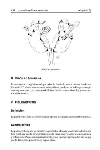 130 (Capítulo 5)
Aprenda medicina sonriendo...
Riñón en herradura.
B. Riñón en herradura
Es un trastorno congénito en el que existe la fusión de ambos riñones dando una
forma de “U”. Generalmente cursa asintomático, puede ser un hallazgo transope-
ratorio y asociarse con trastornos del flujo urinario o estenosis de los grandes va-
sos abdominales.
V. PIELONEFRITIS
Definición
La pielonefritis es la infección renal que puede involucrar a uno o ambos riñones.
Cuadro clínico
La pielonefritis aguda se caracteriza por fiebre elevada, escalofríos, dolor en la
fosa renal que puede ser espontáneo o a la percusión y asociarse o no a disuria
y polaquiuria. Puede ser un padecimiento grave y poner en peligro la vida, ya que
puede dar lugar a pionefrosis y sepsis grave.
 
