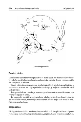154 (Capítulo 8)
Aprenda medicina sonriendo...
Adenoma prostático.
Cuadro clínico
Los síntomas de la hipertrofia prostática se manifiestan por disminución del cali-
bre y la fuerza del chorro de la orina, polaquiuria, nicturia, disuria y prolongación
del tiempo de la micción.
Todos estos síntomas empeoran con la ingestión de alcohol, estreñimiento y
permanecer sentado por largos periodos de tiempo, y mejoran con el calor local
y el ejercicio.
Este padecimiento constituye una emergencia cuando se manifiesta con una
retención aguda de orina.
La hipertrofia prostática puede dar lugar a la formación de un divertículo vesi-
cal con litiasis vesical, hemorragia e infecciones. Puede llegar a ser causa de insu-
ficiencia renal crónica.
Diagnóstico
El diagnóstico se realiza mediante el cuadro clínico. A la exploración rectal gene-
ralmente se encuentra una próstata crecida, engrosada y de consistencia elástica.
 