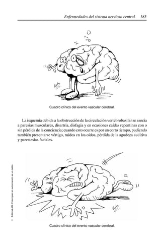 185
Enfermedades del sistema nervioso central
Editorial
Alfil.
Fotocopiar
sin
autorización
es
un
delito.
E
Cuadro clínico del evento vascular cerebral.
La isquemia debida a la obstrucción de la circulación vertebrobasilar se asocia
a paresias musculares, disartria, disfagia y en ocasiones caídas repentinas con o
sin pérdida de la conciencia; cuando esto ocurre es por un corto tiempo, pudiendo
también presentarse vértigo, ruidos en los oídos, pérdida de la agudeza auditiva
y parestesias faciales.
Cuadro clínico del evento vascular cerebral.
 