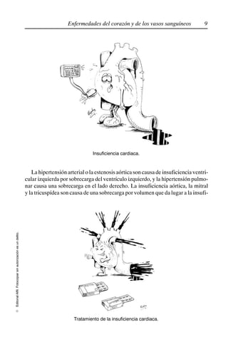 9
Enfermedades del corazón y de los vasos sanguíneos
Editorial
Alfil.
Fotocopiar
sin
autorización
es
un
delito.
E
Insuficiencia cardiaca.
La hipertensión arterial o la estenosis aórtica son causa de insuficiencia ventri-
cular izquierda por sobrecarga del ventrículo izquierdo, y la hipertensión pulmo-
nar causa una sobrecarga en el lado derecho. La insuficiencia aórtica, la mitral
y la tricuspídea son causa de una sobrecarga por volumen que da lugar a la insufi-
Tratamiento de la insuficiencia cardiaca.
 