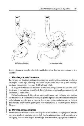 49
Enfermedades del aparato digestivo
Editorial
Alfil.
Fotocopiar
sin
autorización
es
un
delito.
E
Volvulus gástrico. Hernia parahiatal.
fondo gástrico se desplaza hacia la cavidad torácica. Las formas mixtas son fre-
cuentes.
1. Hernias por deslizamiento
La hernias por deslizamiento casi siempre son asintomáticas, rara vez producen
esofagitis por reflujo, son muy frecuentes en pacientes ancianos y 60% se diag-
nostican en pacientes mayores de 60 años de edad.
El diagnóstico se realiza mediante estudios radiológicos con material de con-
traste con el paciente en posición de Trendelenburg, efectuando presión sobre el
abdomen, o endoscopia.
En las hernias por deslizamiento asintomáticas no está indicado ningún tipo
de tratamiento. Cuando existe esofagitis por reflujo se dará el tratamiento médico
señalado con anterioridad y, en caso de que este tratamiento fracase, se deberá
realizar una intervención quirúrgica, recomendándose la funduplicatura de tipo
Nissen.
2. Hernias paraesofágicas
Generalmente ocurren en edad adulta y son asintomáticas, aunque puede referir-
se cierto grado de opresión precordial. Las hernias grandes pueden asociarse a
disfagia y rara vez a esofagitis por reflujo. Son frecuentes y peligrosas complica-
 