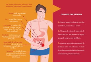 10
3. Qualquer alteração ou ausência de
saída de fezes por três dias ou mais
deverá ser comunicada imediatamente
ao enfermeiro/estomaterapeuta.
2. A limpeza do estoma deve ser feita de
forma delicada. Não deve ser esfregado,
pois pode sangrar com facilidade.
CUIDADOS COM O ESTOMA
Em seu estado normal, o estoma deve
apresentar as seguintes características:
1. Observe sempre a coloração, o brilho,
a umidade, o tamanho e a forma.
Integridade da pele ao redor
do estoma: ela não deve ter
ferimentos, vermelhidão ou
feridas.
Tamanho: é a medida da base
do estoma. Depende do tipo e
local do estoma e varia entre
20 e 90 mm.
Forma: pode ser regular
ou irregular.
Cor: vermelho-vivo ou
rosa-escuro.
Umidade: o estoma deve ser
“molhado”, ou seja, úmido e
brilhante.
Protrusão: é a altura do
estoma e pode variar
“mais pra dentro”ou
“mais para fora”.
10
 