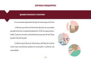 14
QUANDO ESVAZIAR O COLETOR?
O esvaziamento dependerá do tipo de estomia que você tem:
• Coletores para fezes de ileostomia deverão ser esvaziados
quando estiverem com aproximadamente 1/3 de seu espaço preen-
chido. É preciso esvaziar constantemente para que ele não fique
pesado e descole da pele.
• Coletores para fezes de colostomias, pelo fato de as fezes
serem mais consistentes, podem ser esvaziados s conforme sua
necessidade.
DÚVIDAS FREQUENTES
1/3
 