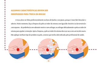 18
A troca deve ser feita preferencialmente na hora do banho e em jejum, porque é mais fácil descolar o
adesivo. Neste momento, faça a limpeza da pele ao redor do estoma com água (do chuveiro ou da torneira) e
com espuma – de preferência com sabonete neutro e sem esfregar, ou esfregar delicadamente a pela ao redor do
estoma para ajudar a remoção. Após a limpeza, a pele ao redor do estoma deve ser seca com um tecido macio.
Não aplique nenhum tipo de produto na pele, a menos que tenha sido indicado pelo profissional de saúde.
ALGUMAS CARACTERÍSTICAS DEVEM SER
OBSERVADAS PARA TROCA DA BOLSA!
 