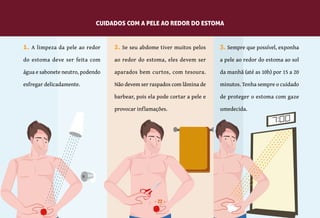 22
1. A limpeza da pele ao redor
do estoma deve ser feita com
água e sabonete neutro, podendo
esfregar delicadamente.
2. Se seu abdome tiver muitos pelos
ao redor do estoma, eles devem ser
aparados bem curtos, com tesoura.
Não devem ser raspados com lâmina de
barbear, pois ela pode cortar a pele e
provocar inflamações.
3. Sempre que possível, exponha
a pele ao redor do estoma ao sol
da manhã (até as 10h) por 15 a 20
minutos. Tenha sempre o cuidado
de proteger o estoma com gaze
umedecida.
CUIDADOS COM A PELE AO REDOR DO ESTOMA
22
 