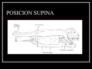 POSICION SUPINA 