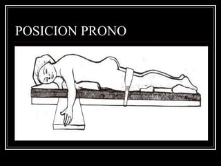 POSICION PRONO 
