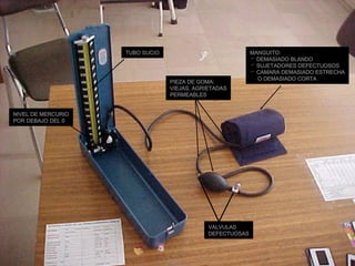 TUBO SUCIO NIVEL DE MERCURIO POR DEBAJO DEL 0 VALVULAS DEFECTUOSAS PIEZA DE GOMA: VIEJAS, AGRIETADAS PERMEABLES MANGUITO: DEMASIADO BLANDO SUJETADORES DEFECTUOSOS CAMARA DEMASIADO ESTRECHA O DEMASIADO CORTA 