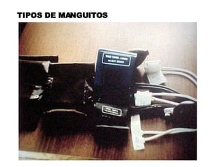 TIPOS DE MANGUITOS 