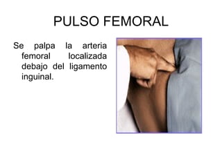 PULSO FEMORAL Se palpa la arteria femoral localizada debajo del ligamento inguinal. 