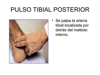PULSO TIBIAL POSTERIOR Se palpa la arteria tibial localizada por detrás del maléolo interno. 