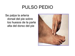 PULSO PEDIO Se palpa la arteria dorsal del pie sobre los huesos de la parte alta del dorso del  pie 