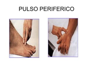 PULSO PERIFERICO 