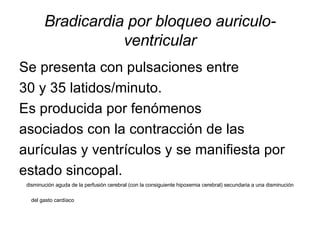 Bradicardia por bloqueo auriculo-ventricular Se presenta con pulsaciones entre 30 y 35 latidos/minuto.  Es producida por fenómenos asociados con la contracción de las aurículas y ventrículos y se manifiesta por estado sincopal. disminución aguda de la perfusión cerebral (con la consiguiente hipoxemia cerebral) secundaria a una disminución del gasto cardíaco   