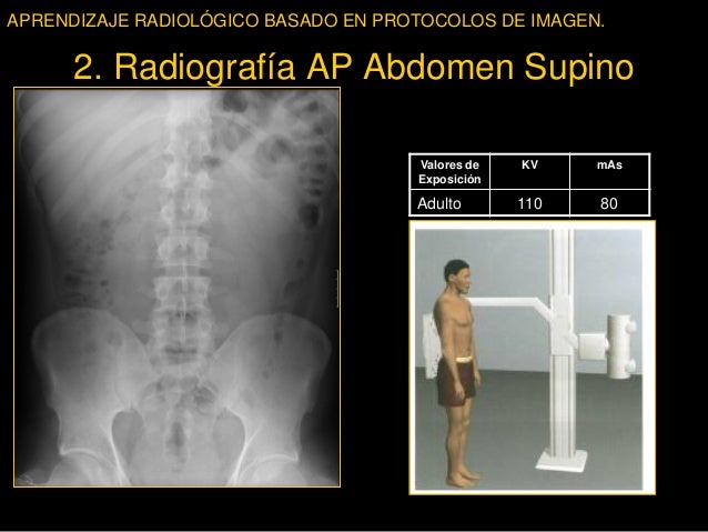 Aprendizaje radiológico basado en protocolos de imagen