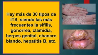 Hay más de 30 tipos de
ITS, siendo las más
frecuentes la sífilis,
gonorrea, clamidia,
herpes genital, chancro
blando, hepatitis B, etc.
 