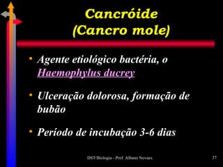 Cancróide (Cancro mole) Agente etiológico bactéria, o  Haemophylus ducrey Ulceração dolorosa, formação de bubão Período de incubação 3-6 dias 