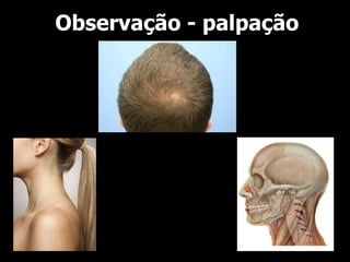 Observação - palpação
 