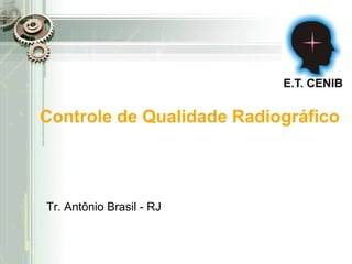 Controle de Qualidade Radiográfico




Tr. Antônio Brasil - RJ
 