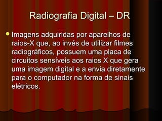 Radiografia Digital – DR
 Imagens adquiridas por aparelhos de

raios-X que, ao invés de utilizar filmes
radiográficos, possuem uma placa de
circuitos sensíveis aos raios X que gera
uma imagem digital e a envia diretamente
para o computador na forma de sinais
elétricos.

 