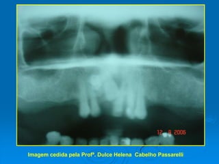 Etiologia: desconhecida