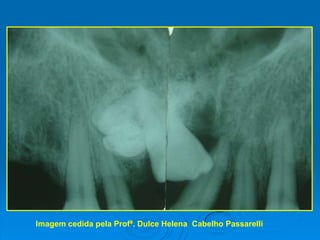 Diagnóstico: exames radiográficos  